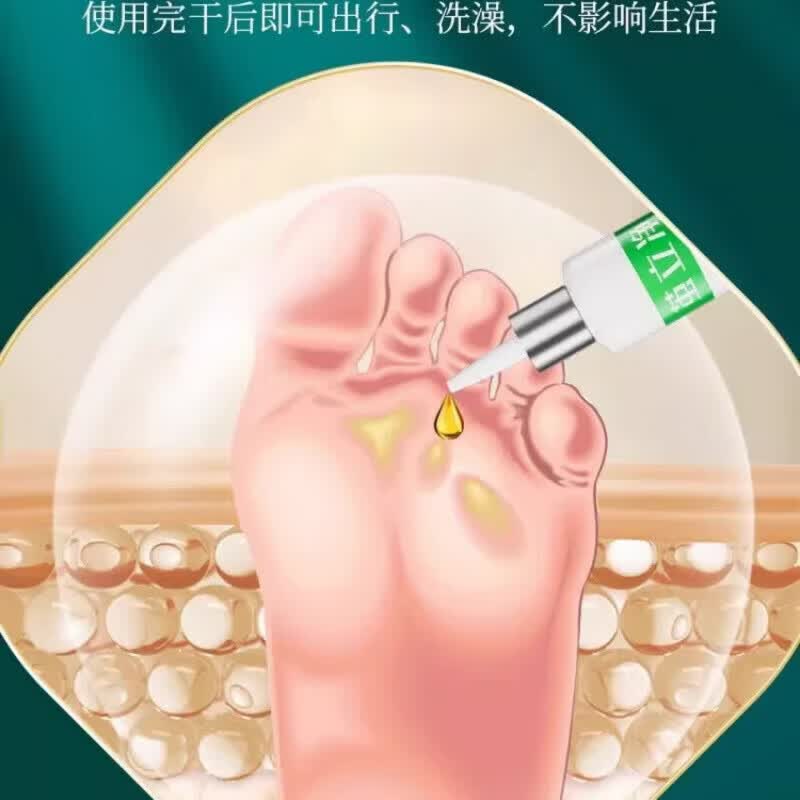 黄辅堂茧立净老茧子脚茧厚眼鸡草本萃取手足脚底板用正品 买五送五  到手10瓶 正品保障