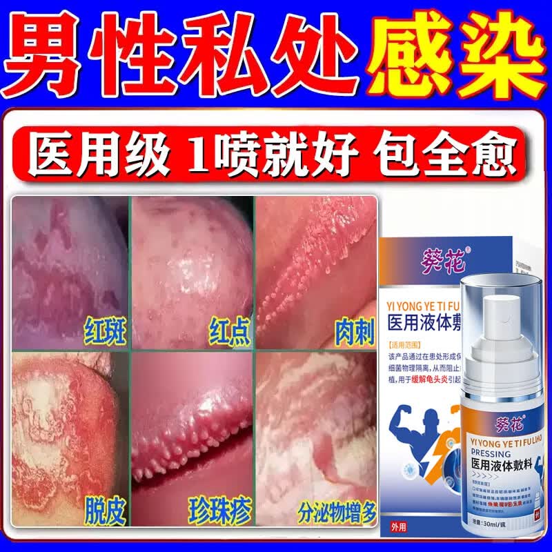 同仁堂(TRT)龟头炎专用膏药龟头真菌感染红肿包皮炎白垢豆腐渣红点瘙痒喷剂 买2送1【1喷就好】 特效男士私处杀菌消炎止痒喷剂 京东折扣/优惠券
