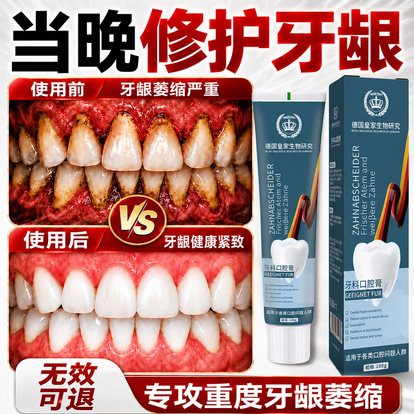 SOVIP德国牙膏护龈固齿牙龈I萎缩修复再I生牙根外露牙周I炎牙齿I松动 【牙龈养护体验装】1支