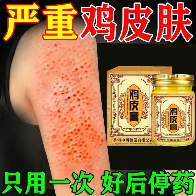 香港鸡皮肤疙瘩毛周角化症去除大腿胳膊手臂疙瘩鸡皮膏身体护理 【中度鸡皮】 50g 2瓶 润滑嫩肌肤