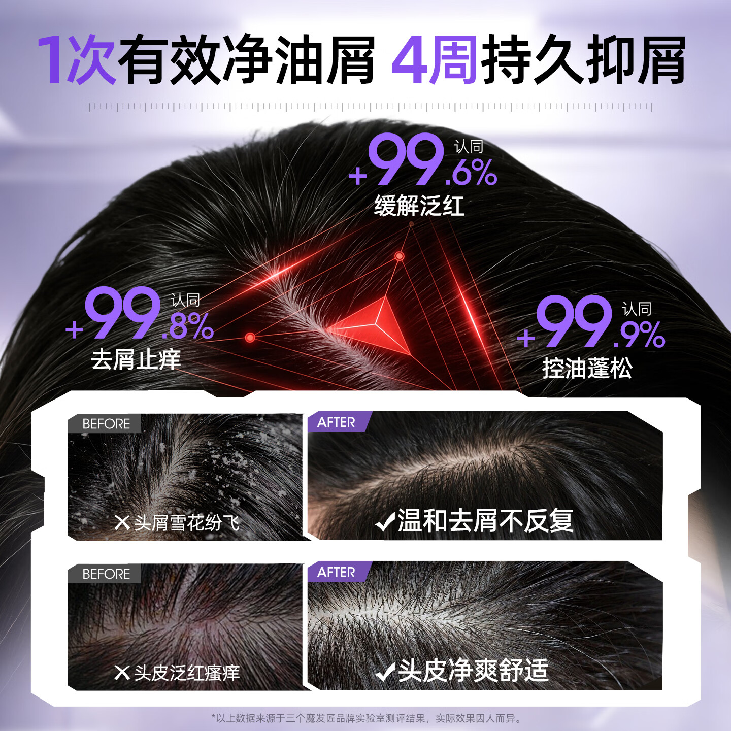 三个魔发匠二硫化硒洗发水去屑止痒控油持久柔顺蓬松清痘男女士洗头膏露第1 【强效去屑】二硫化硒洗发水 300ml*1瓶 体验装