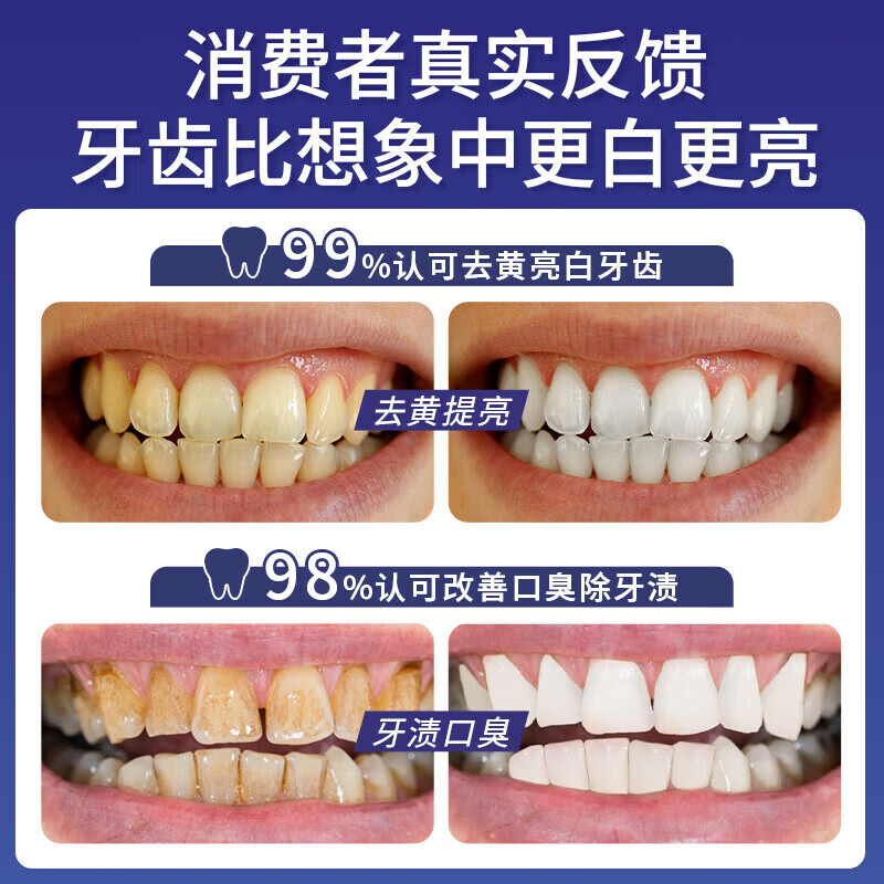 MANSCHKUI德国美白牙膏去黄去渍清新口气去烟渍儿童成年人含氟护龈金榜第一 2支周期装【家庭共享】 牙膏