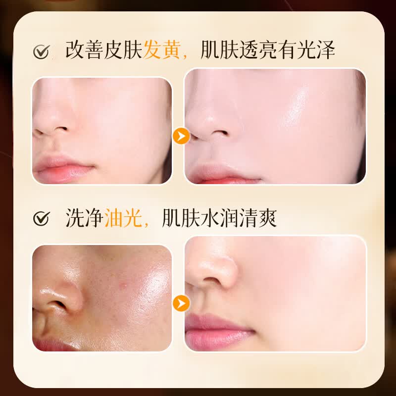 SKT天然草本七子白养肤皂控油清洁沐浴洁面香皂持久留香全身 SKT七子白养肤皂100g(赠送起泡网)