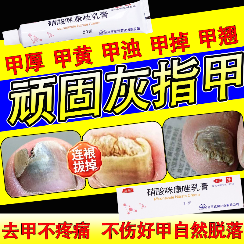 灰指甲专用otc药灰指甲特甲厚效药根据说明书治 灰指甲药真菌感染脱甲
