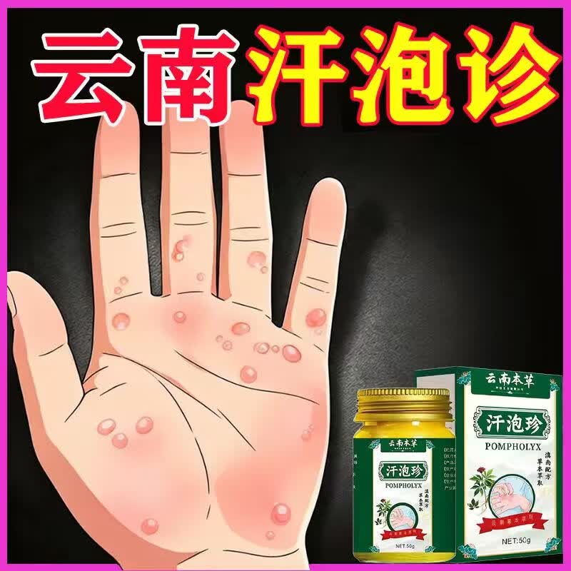 云南汗泡疹本草膏疱珍抑菌汗孢疹手上起小汗泡汗泡珍瘙痒抑菌膏 1盒*50g[初步效果】