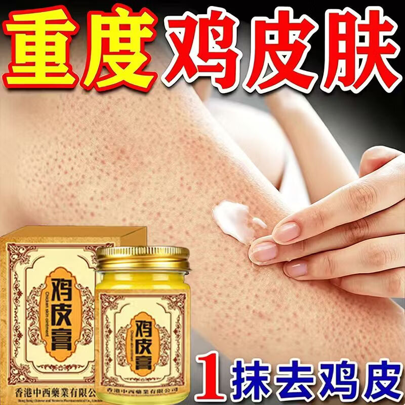 香港鸡皮肤疙瘩毛周角化症去除大腿胳膊手臂疙瘩鸡皮膏身体护理 【轻度鸡皮】 50g 1瓶 温和无刺激