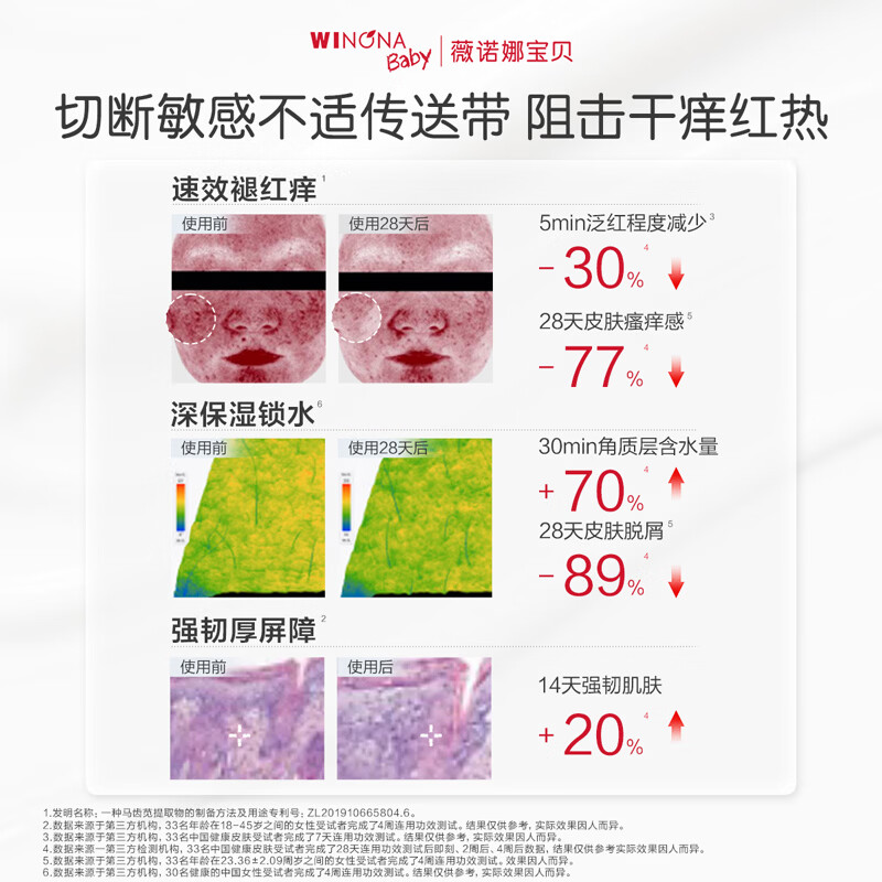 薇诺娜宝贝舒润霜宝宝爆款特护霜舒缓皮肤干痒红湿疹儿童专研婴幼童面霜 【口碑推荐】舒润霜50g