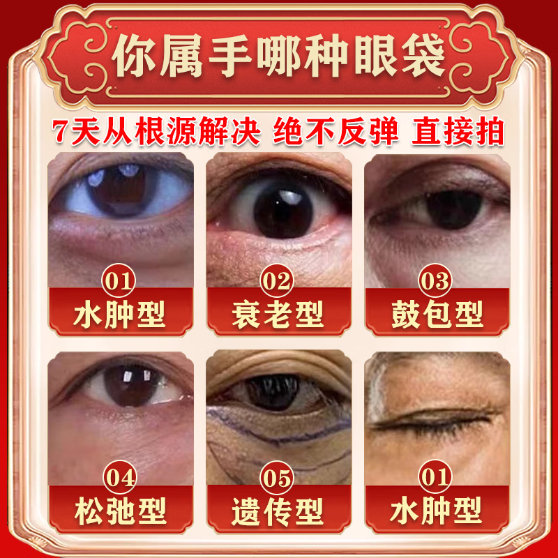 欧诱（Eurpattract）眼袋霜去大眼袋严重中老年专用消除重度男女士眼袋祛去除神器贴膜 一盒试用装 提拉紧致抗皱淡化黑眼圈最好的眼霜