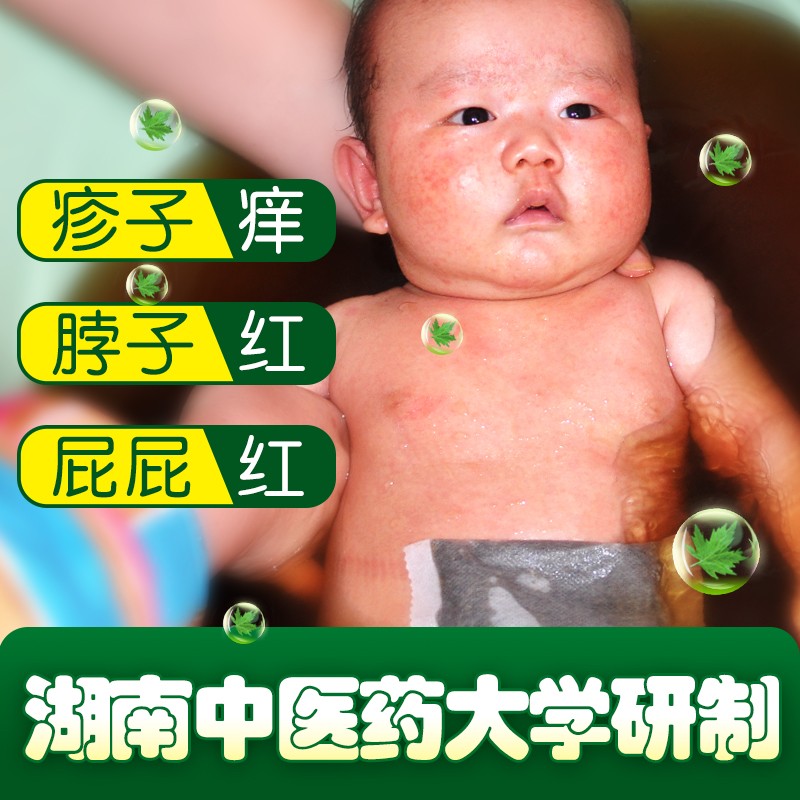艾裕婴幼儿宝宝泡澡包 草本艾叶薄荷包 针对红屁屁湿痒泡澡护理 062薄荷润肤(红屁屁)20g*12袋