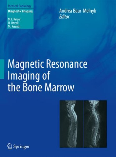 预订 magnetic resonance imaging of the bone marrow