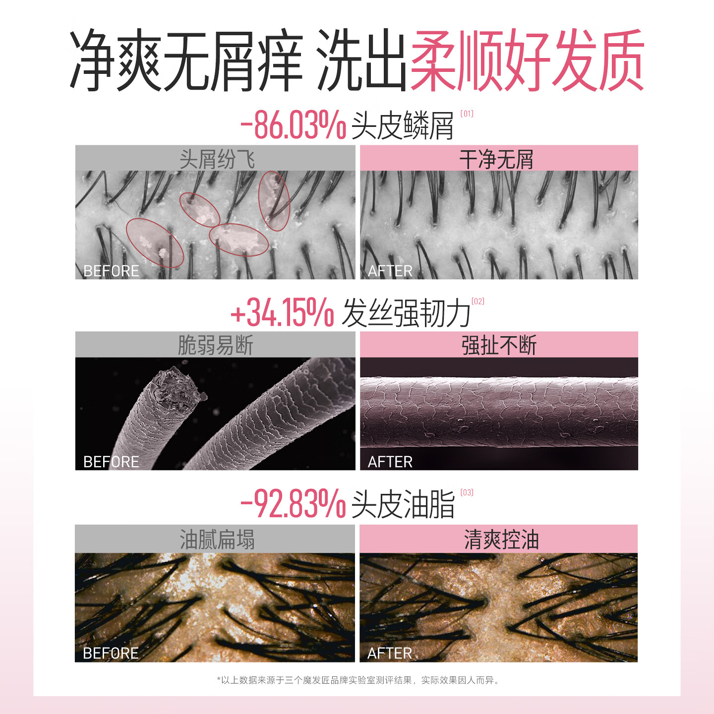 三个魔发匠二硫化硒洗发水去屑止痒控油持久柔顺蓬松清痘男女士洗头膏露第1 【柔顺去屑】二硫化硒洗发水 400ml*1瓶