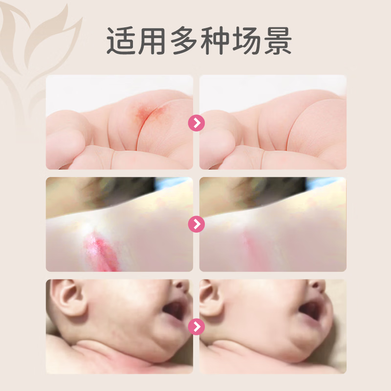 宝莉康柠特护紫草油婴儿紫草油红屁屁专用护臀膏宝宝护臀霜 【短期使用】特护紫草油15ml