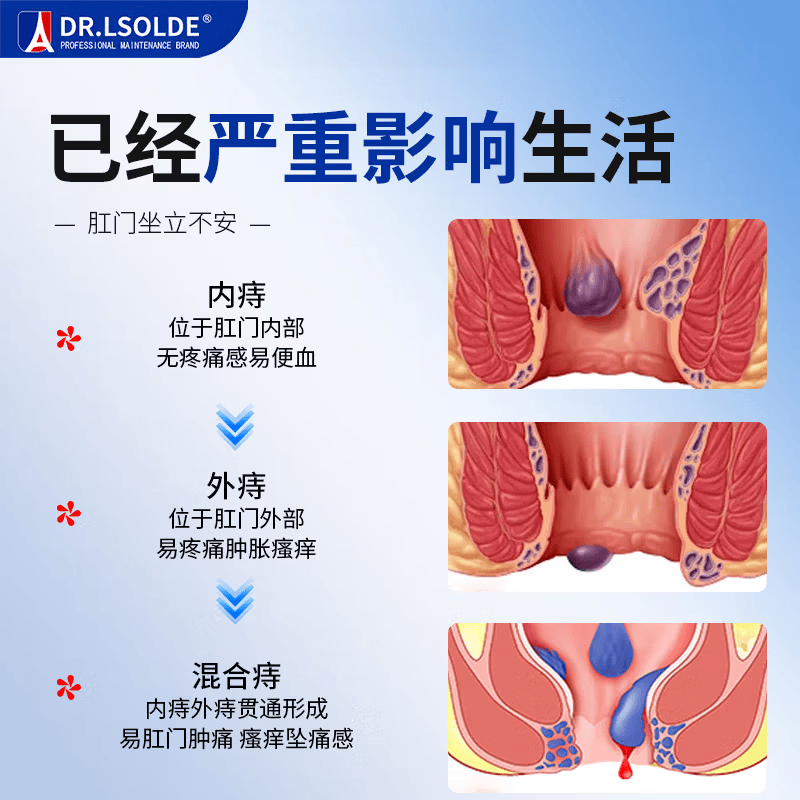 痔疮凝胶内外混合痔肉球脱落肛门瘙痒便血疼痛红肿肛裂 1盒装 【稳固装】 【官方直售 京质保障】