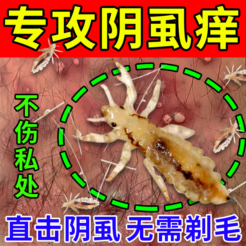 阴虱膏药男女私处通用治i疗阴部瘙痒去除疥虫虱立净有虫卵一扫 1盒装