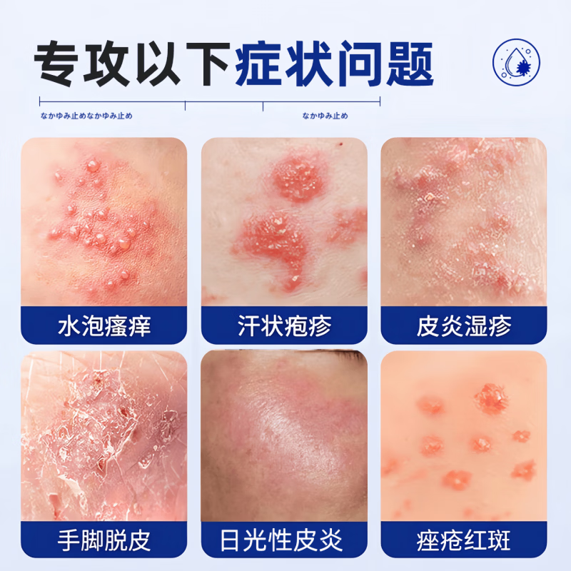 新适确得卤i米松三i氯生乳膏适用于脂溢性皮炎痒湿湿疹神经性皮炎抑菌止痒 两支疗程装 【正品直售 京质保障】