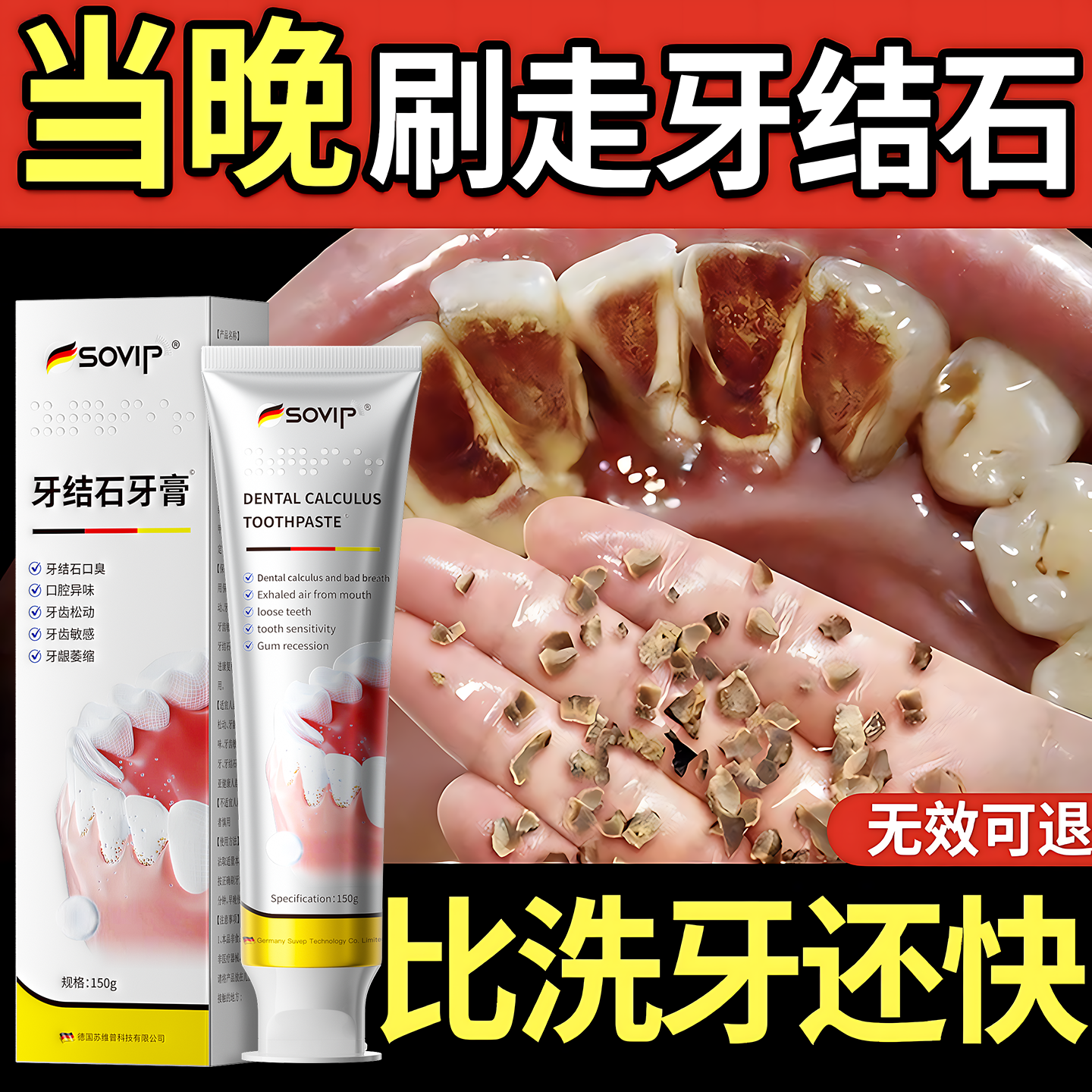 SOVIP牙结石专用牙膏去牙结石去黄去渍美白除臭清新口气去口臭清理神器 2支*150g周期装【溶解牙垢 美白牙齿】