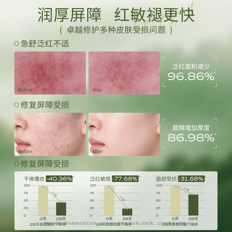雾屿森林小露珠oou精华露油湿敷水补水保湿男女士爽肤水送七夕情人节礼物 360ml丨三瓶焕养周期（赠小样*3）到手6件