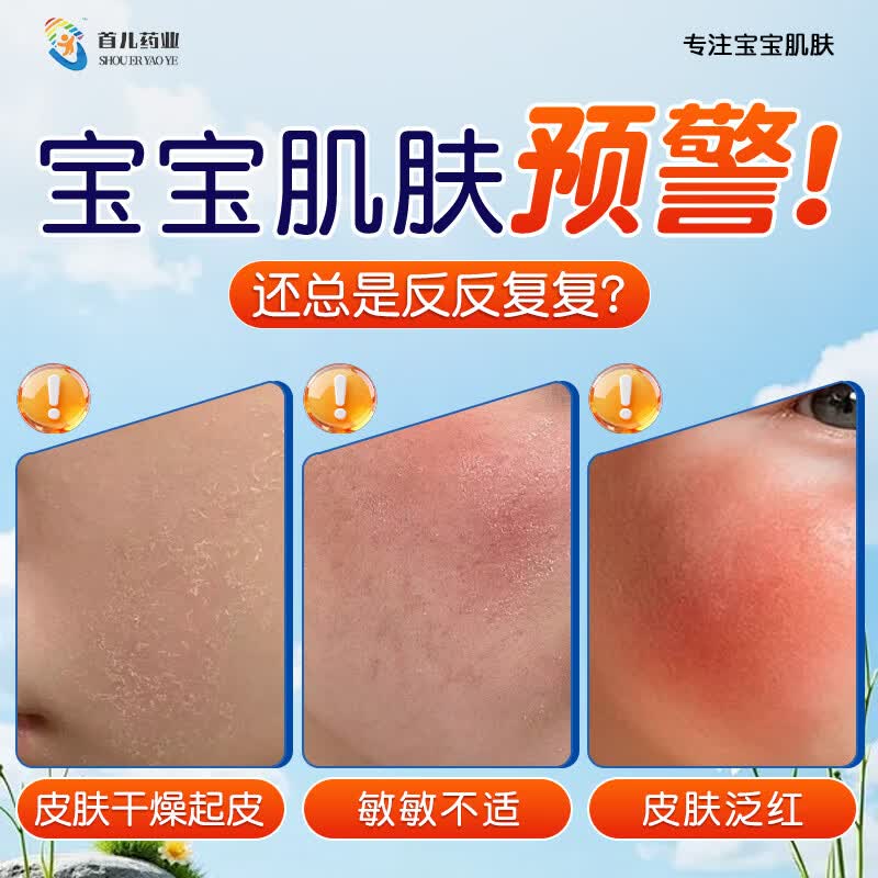 首儿药业儿研所儿童面霜50g婴儿湿疹霜高保湿滋润身体乳精华四季全身可用 【金榜 | 硅霜】15min舒缓保湿 【婴幼配方】儿研所新生儿童面霜秋冬滋润保湿无激素