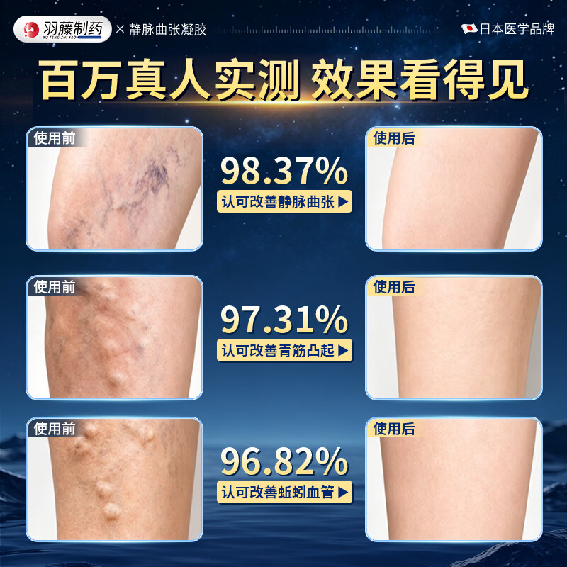 羽藤制药静脉曲张专用膏药蚯蚓腿疏通血管医用远红外治疗凝胶冷敷日本进口 【蚯蚓腿 青筋凸起专用】3盒装 至快次日达&无效包售后&日本品牌