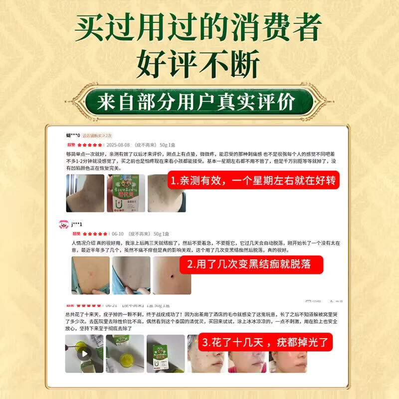 泰国清优灵祛疣膏脖子上小肉粒清疣灵疣体脱落膏丝状扁平肉粒全身适用 【疣不再来】1盒 50g 1盒 1