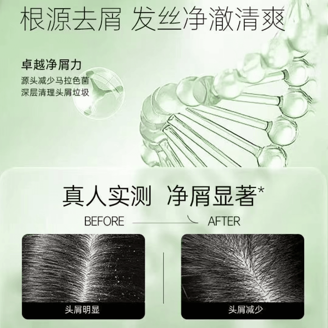 诗裴丝Spes诗裴丝胶原系列750ml 洗发水控油蓬松去屑柔顺止痒男女通用 胶原鱼子酱修护蓬松洗发露750ml