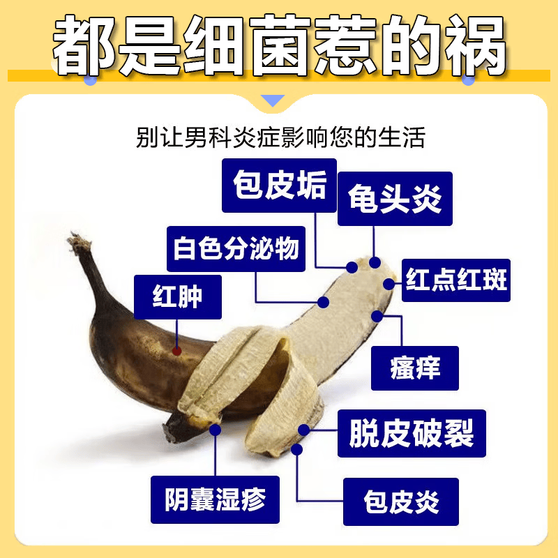 [川石]克霉唑乳膏 男性真菌感染龟头炎白垢豆腐渣男士专用膏药红肿瘙痒丘疹红点白点念珠菌性霉菌男科用药 1%*10g 1盒装 【快速缓解私处瘙痒红肿】