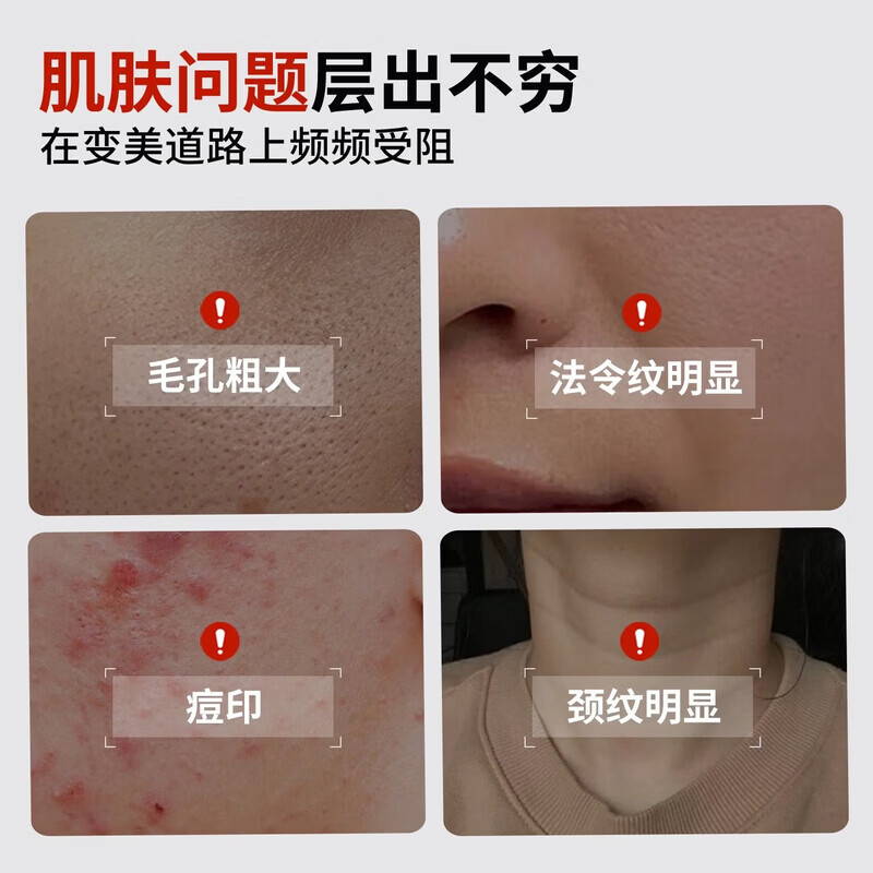 ENEK护理膜ENEK凝胶细致毛孔淡化法令纹颈纹痘印医用重组胶原蛋白 2盒