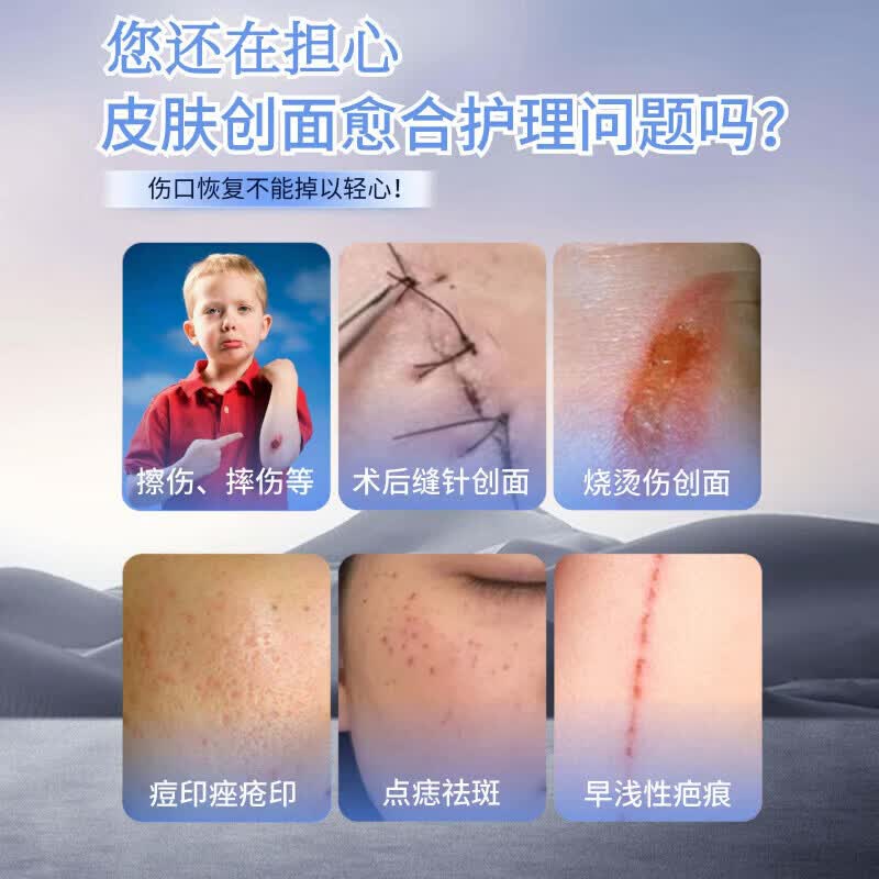 外用人i粒细i胞凝胶巨i噬细i胞刺i激因子凝胶重组牛i碱性细胞生长 1盒【见效装】   【品牌直售】