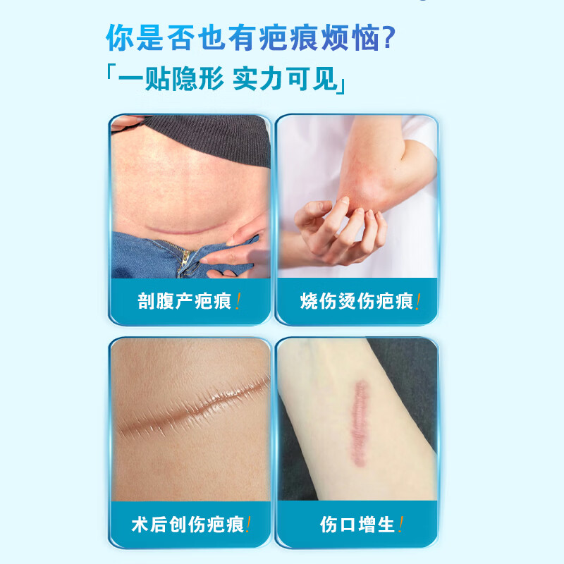 暨可复医用硅酮疤痕修复贴腹产术后伤口防水隐形儿童孕妇通用甲状腺通用 2盒【护理装】送收纳盒*1+生理盐水*1