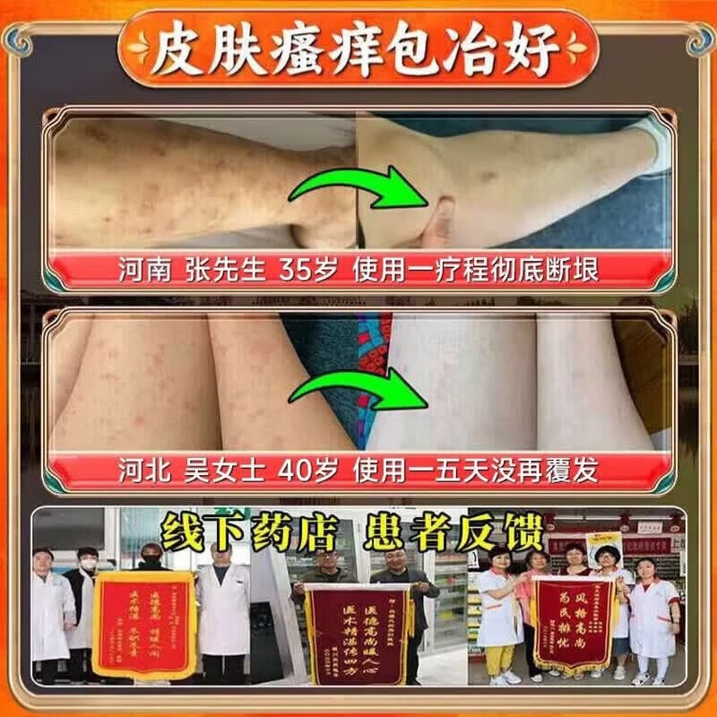 云南本草止痒断痒王杀菌100%特傚膏皮焱湿诊真菌皮肤干燥瘙痒止痒皮肤瘙痒 50g*1盒特效膏 1