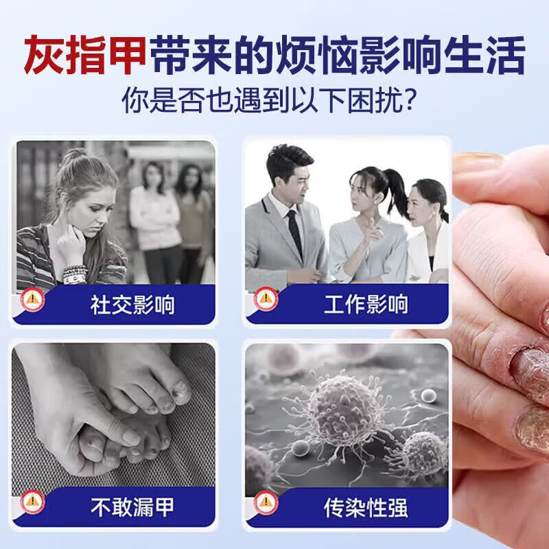 国药药材重度灰指甲100%特效专用的药特殊效专用抑菌液灰甲净套装 五盒装【去灰甲不返复】 灰指甲100%特效专用的药