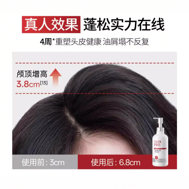 舒蕾(SLEK)Pro控油去屑洗发水 氨基酸头皮油性发质强韧修护蓬松洗护套装男女 头皮专研洗护套装430ml*2瓶 PRO头皮专研