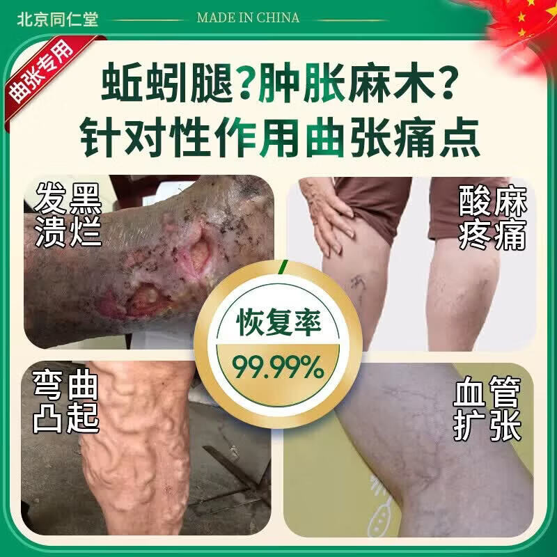 北京协和医学院静脉曲张专用膏药蚯蚓腿疏通血管堵塞进口药冷敷凝胶治疗静脉舒膏 一盒【北京同仁堂】新品限时优惠 特效静脉曲张喷雾专用贴的