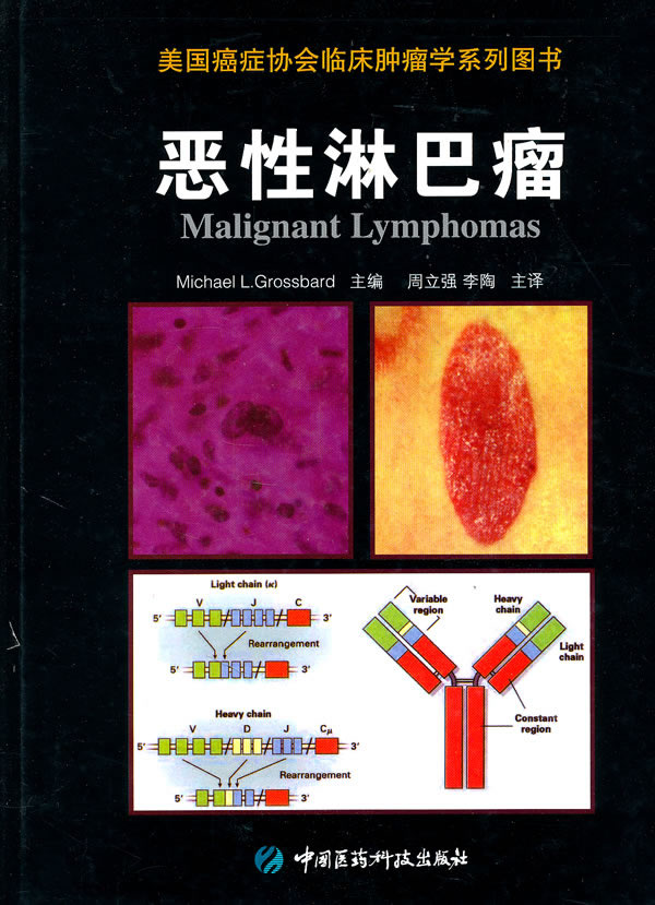 恶性淋巴瘤【正版特惠】