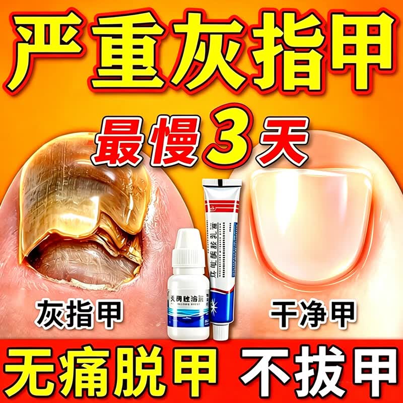 [金归]环吡酮胺乳膏 环吡酮乳膏+搽剂治疗灰指甲专用药最特新效药指甲增厚发黄变厚真菌感染皮肤用药 1%*20g 1盒装 【+溶液 双效治灰甲】