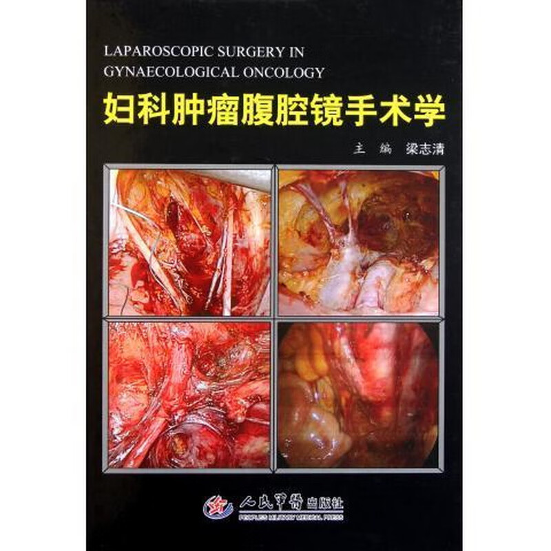 妇科肿瘤腹腔镜手术学