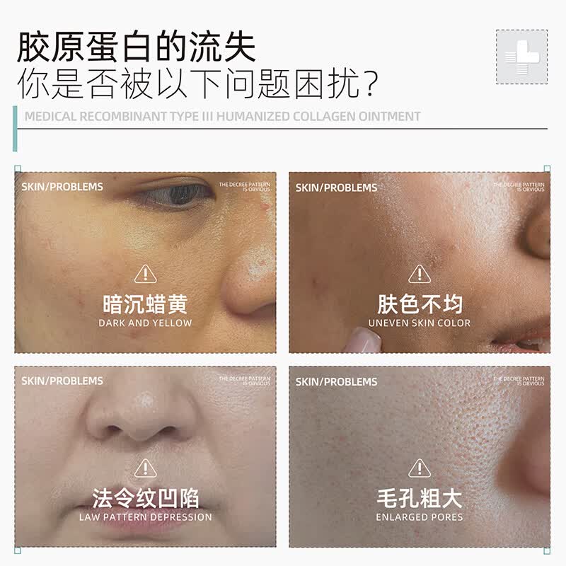 ZHUOCONA 卓康纳胶原霜zoa胶原敷料卓康纳蛋白霜zoa医用重组胶原蛋白敷料面霜 一盒体验装【多买更划算】