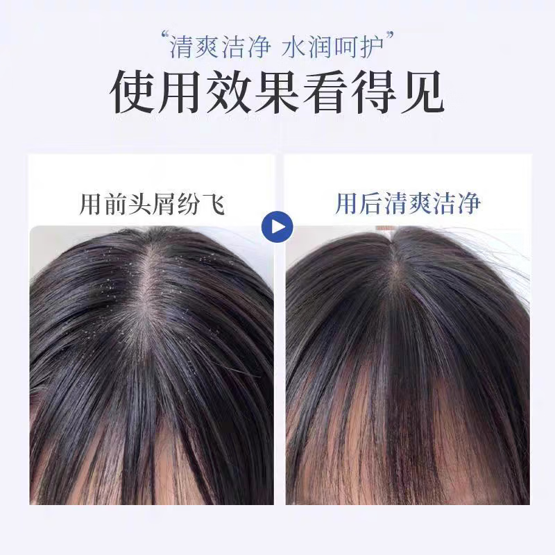 C7二硫化硒去屑洗发露300g控油净屑清爽蓬松油头多屑发质单双瓶可选 一瓶300g