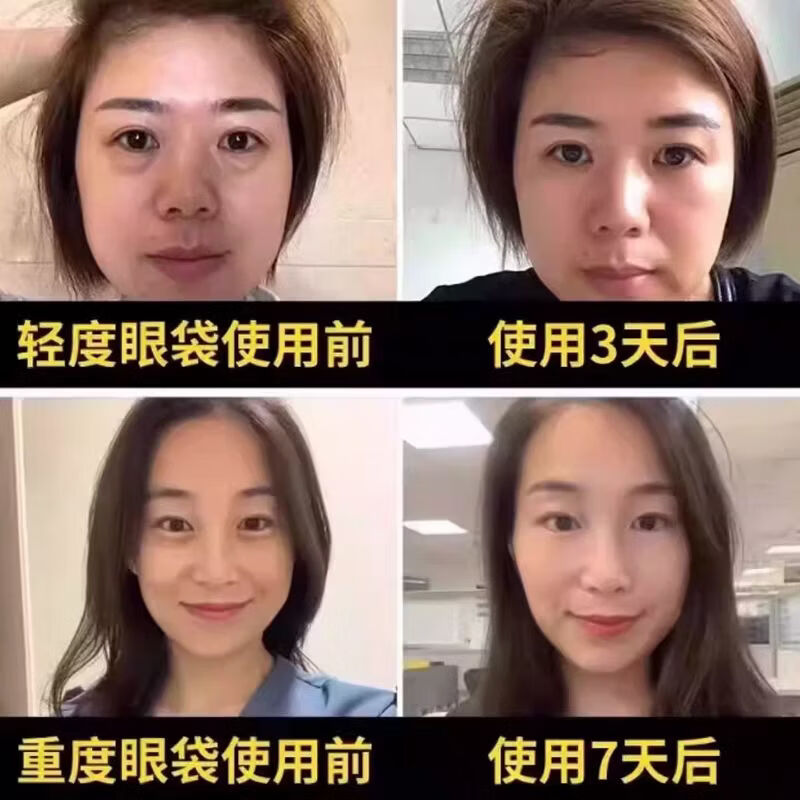 SKALL中药草本人参虫草眼霜紧致抗皱逆颜淡化黑眼圈熬夜细纹大眼袋提拉 【买二送一】到手3瓶【解决各种眼部问题】