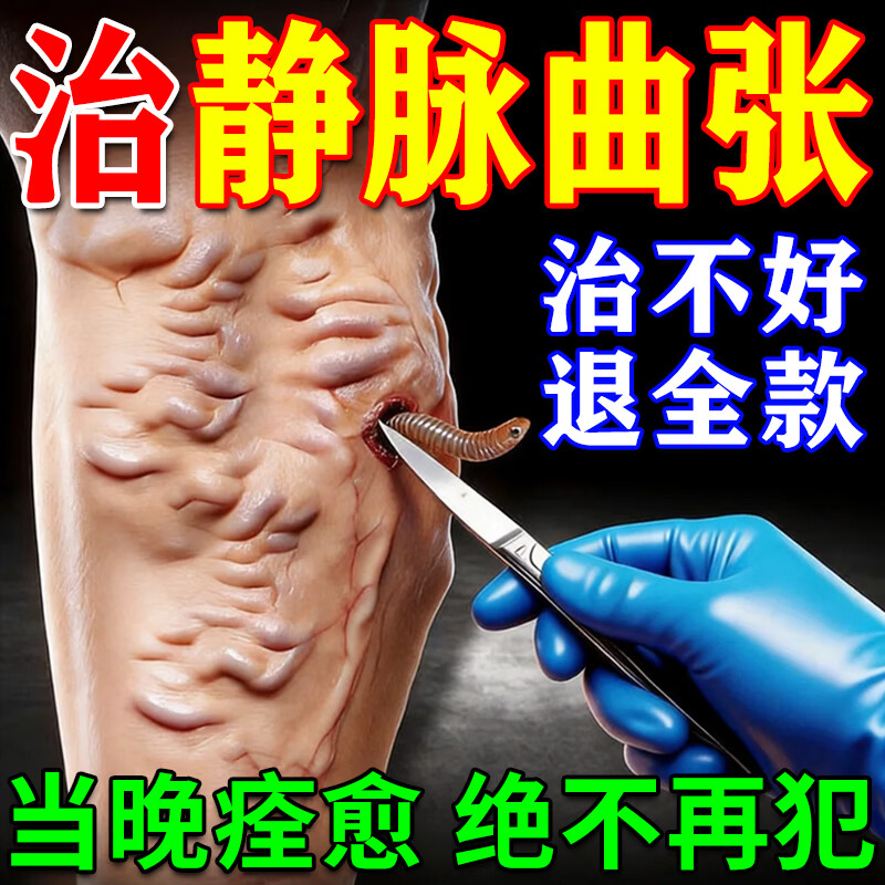 北京协和医学院静脉曲张专用膏药蚯蚓腿疏通血管堵塞进口药冷敷凝胶治疗静脉舒膏 特效1盒【静脉曲张专用】 特效静脉曲张喷雾专用贴的