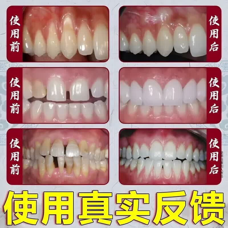南京同仁堂抑菌去口臭祛去黄去牙渍去烟渍牙垢口气重嘴巴臭口腔异味克星 100%特效【买2送1】口苦口臭 牙膏金榜第一