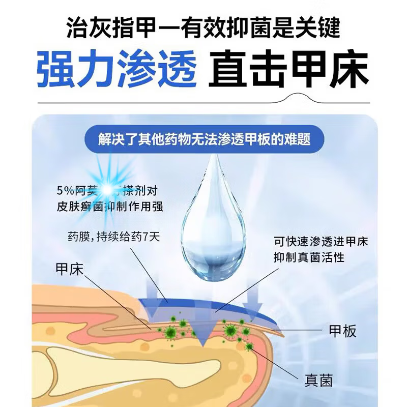 洛芙盐洛芙酸阿啊莫罗芬搽剂5%灰指甲正品2ml洛芙真菌感染脱甲官 5盒装 买三赠二【巩固装】 【官方授权/品质保障】