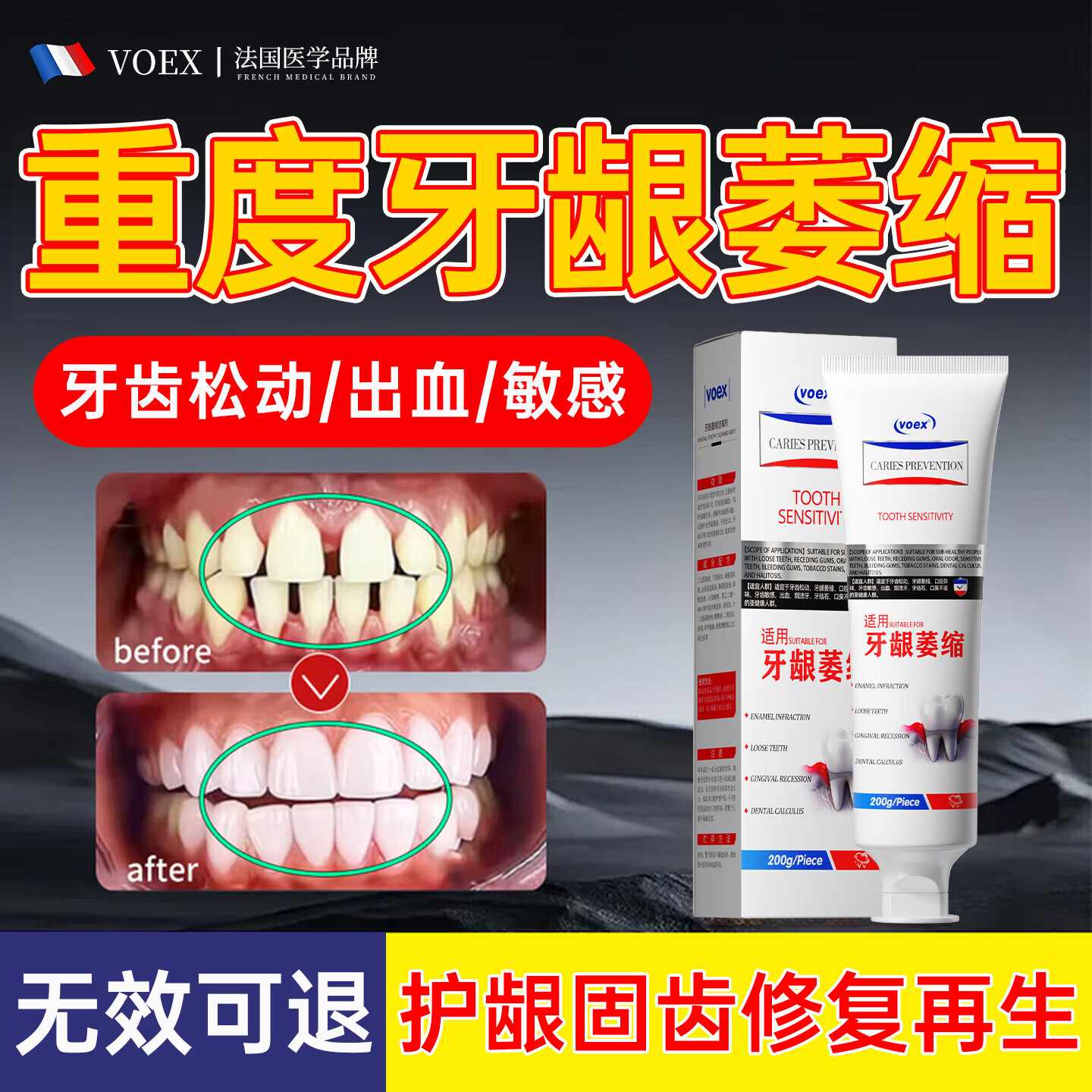 VOEX法国牙龈I萎缩专用牙膏护龈固齿修复再生牙周I炎牙齿I松动根外露