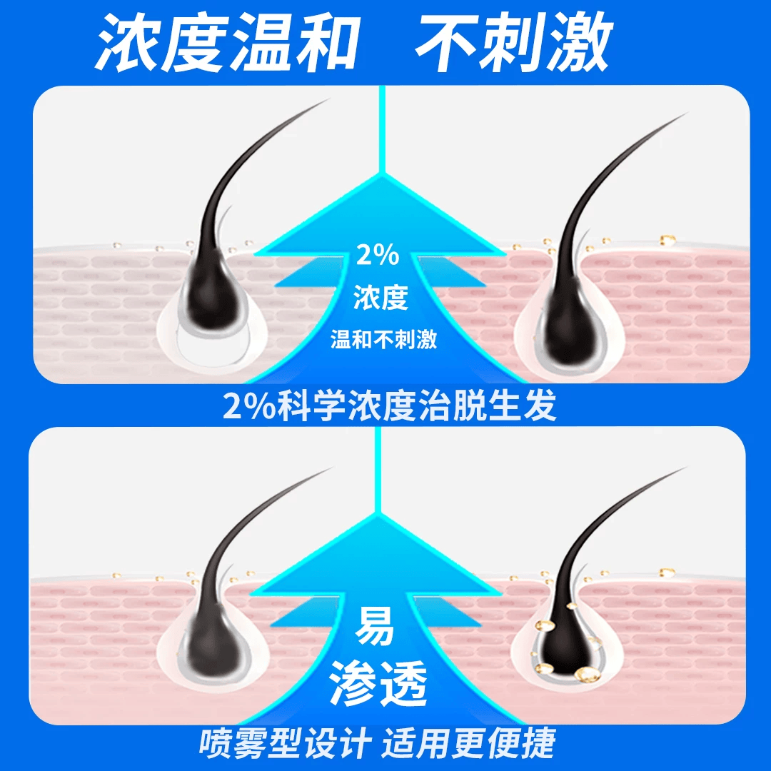 [斯必申]米诺地尔搽剂 2%*100ml 1盒装 男性女性脱发严重男专用防脱生发发际线增长脱发斑秃