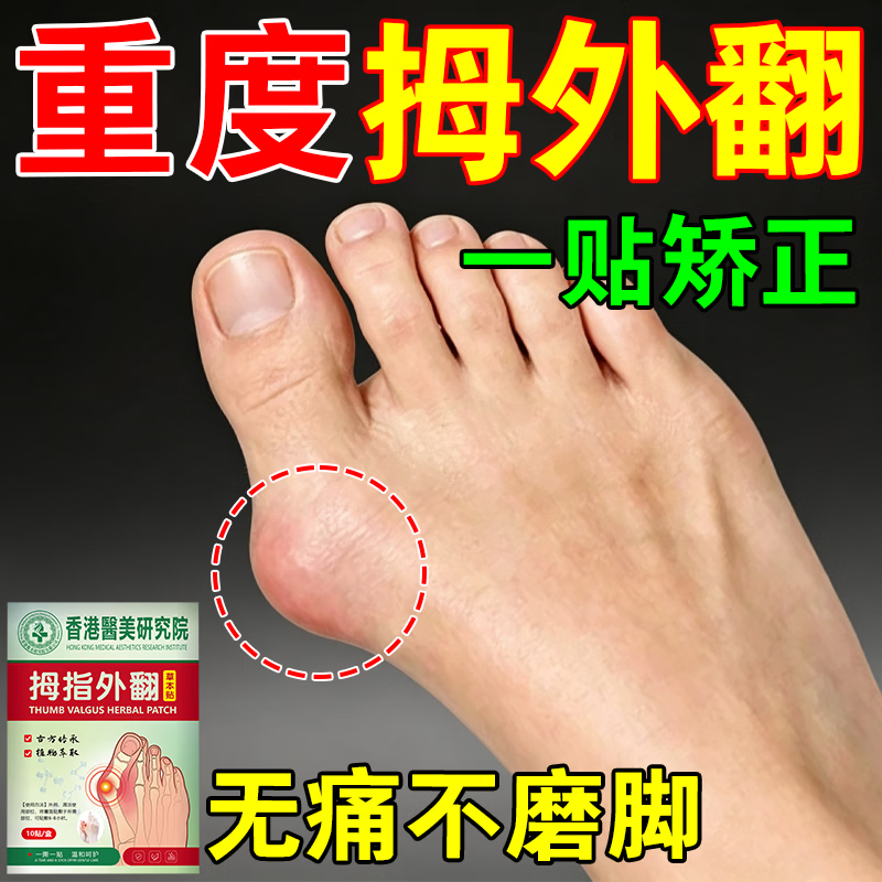 拇指外翻贴膏药大脚骨外翻拇囊炎大脚趾矫正神器关节胀痛专用膏药 100%特效:买3送2 【必冶好】.