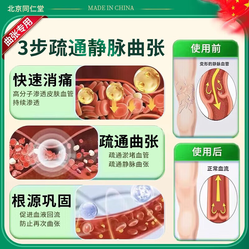 北京协和医学院静脉曲张专用膏药蚯蚓腿疏通血管堵塞进口药冷敷凝胶治疗静脉舒膏 一盒【北京同仁堂】新品限时优惠 特效静脉曲张喷雾专用贴的