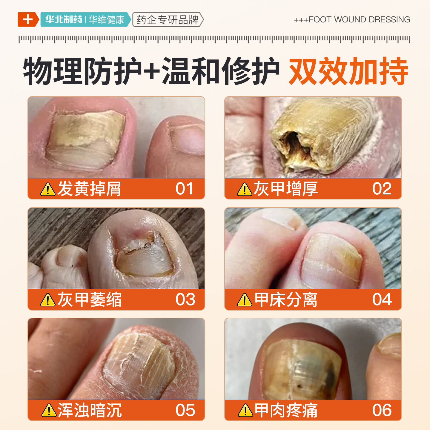 今华维华北制药华维健康甲康灵灰指甲抑菌液脱甲真菌感染增厚脱落甲沟炎 5瓶【重度推荐】萎缩 变形 增厚