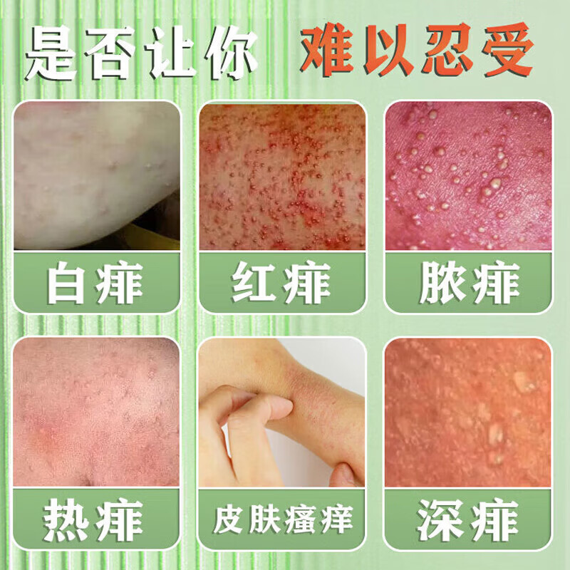 云南本草痱子水祛痱止痒祛热抑菌成人婴幼儿童通用金银花热痱水专用喷雾剂 1瓶装【体验装】祛痱止痒专用