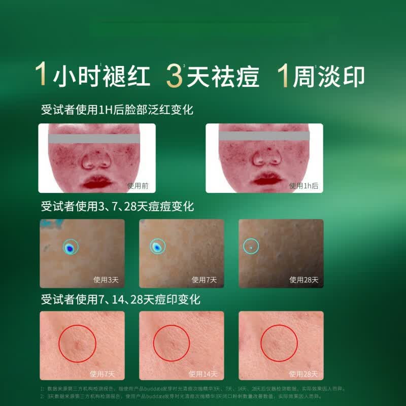 黛熙梦净颜祛痘焕肤精华液祛痘多因多肽水杨酸舒缓保湿痘痘敏感肌可男女 5支 买三赠二【老客囤货】 【全新配方 新品上市】