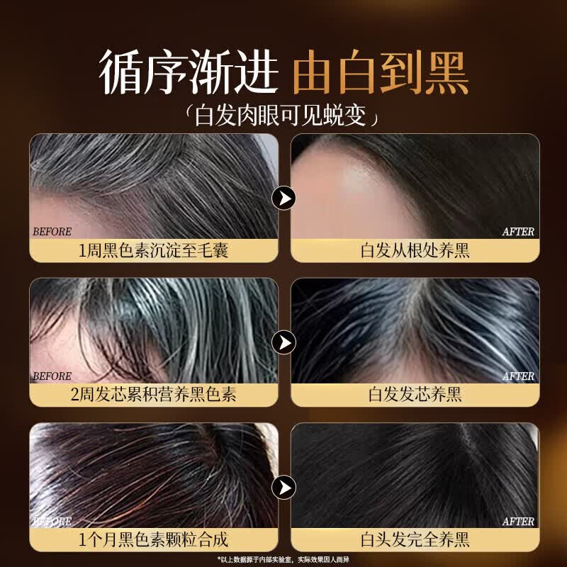 元羽堂防脱洗发水生i发增密固发育发男女通用蓬松控油清爽去屑改善毛躁 5瓶 买3赠2【99%的顾客囤货选择】 【全新配方 新品上市】